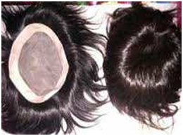 Hair-Bonding-camouflaging-tricks-face-value-hair-transplant-clinic-in mumbai-india-1